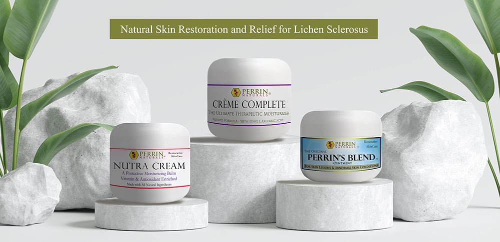 Creme Complete, Perrin's Blend, Nutra Cream Natural Relief for Lichen Sclerosus