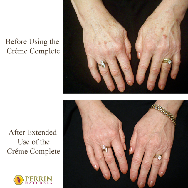 Creme Complete - Skin before and after